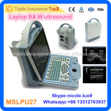 2016 Neueste MSLPU27-I Laptop-Stil Portable Ultraschall-Scanner Low Price Portable Ultraschall-Maschine / Mini-Laptop Ultraschall-Scan